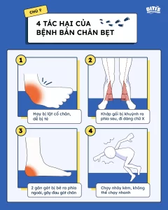 bet restriction là gì - Image 4