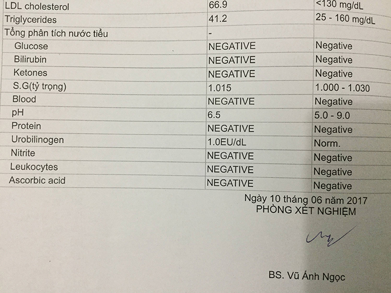 negative EV là gì - Image 2